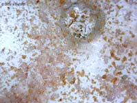 Acari di colore rosato