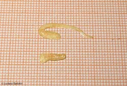 frammenti del baco della tenia su carta millimetrata frammenti del baco della tenia su carta millimetrata